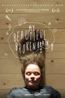 My Beautiful Broken Brain izle