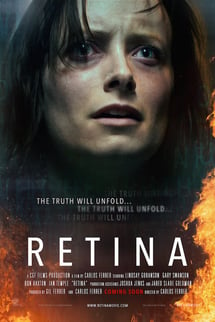 Retina izle